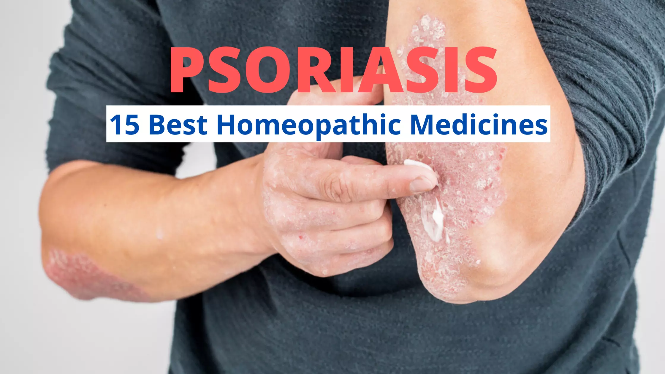 Homeopathic Medicines For Psoriasis