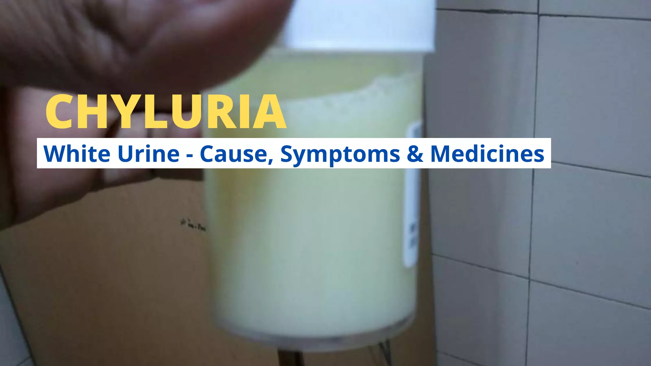 Chyluria Symptoms, Causes, Diagnosis Homeopathic Medicines