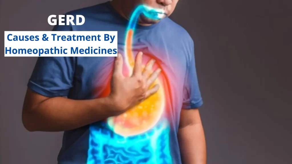 Homeopathy for GERD - Causes, Symptoms and Treatment