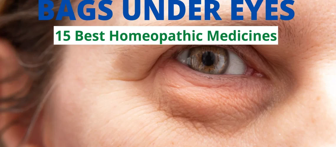 Homeopathic Medicine for Bags Under Eyes