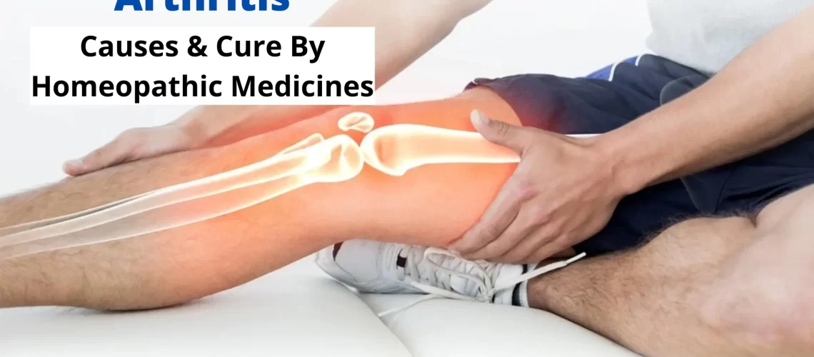 Homeopathy for Arthritis - Causes, Symptoms, Cure and Medicines
